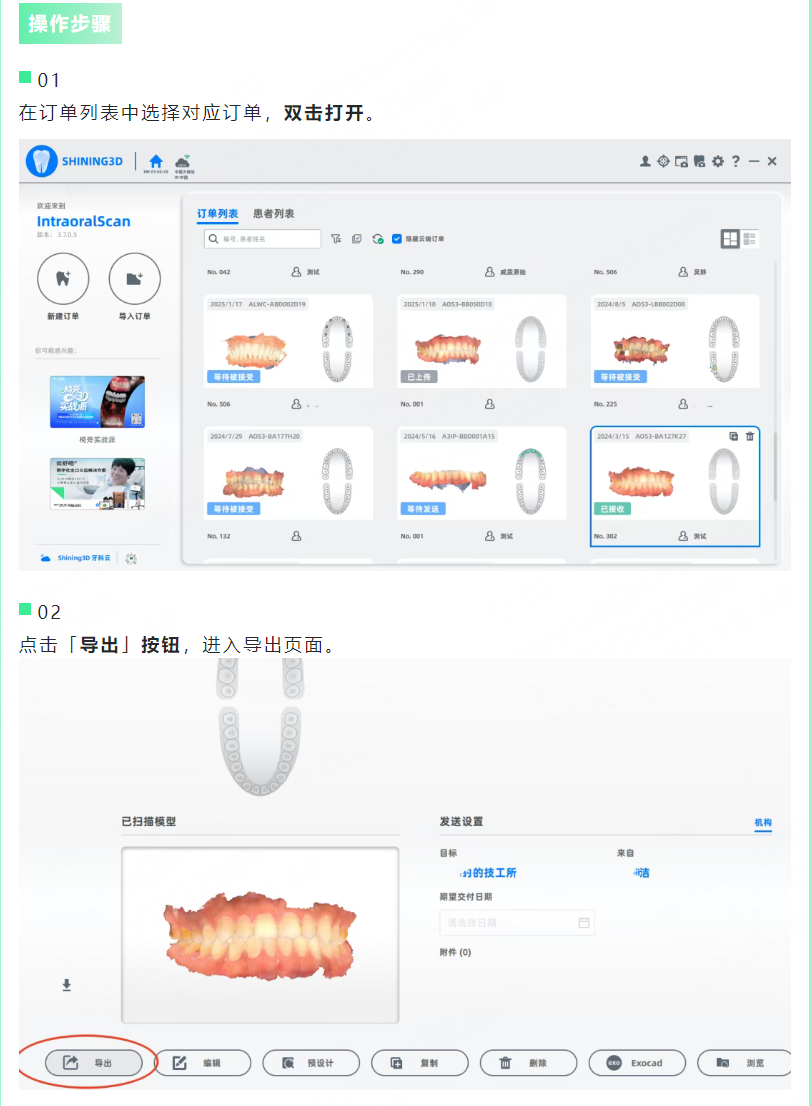口扫数据如何导出