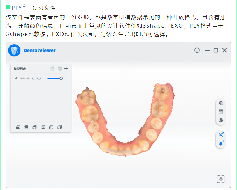 口扫数据如何导出