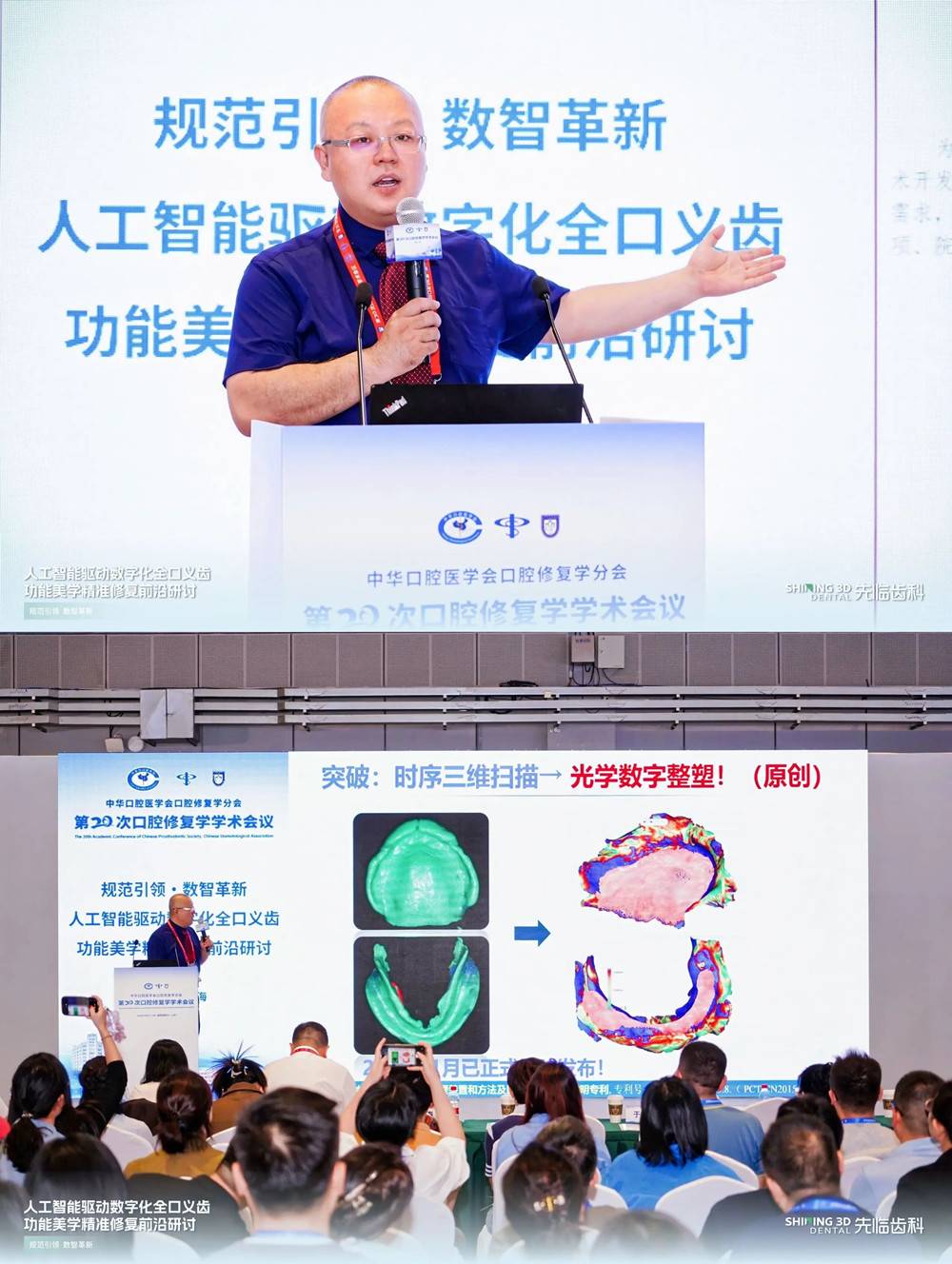 先临齿科人工智能驱动数字化全口义齿功能美学精准修复前沿研