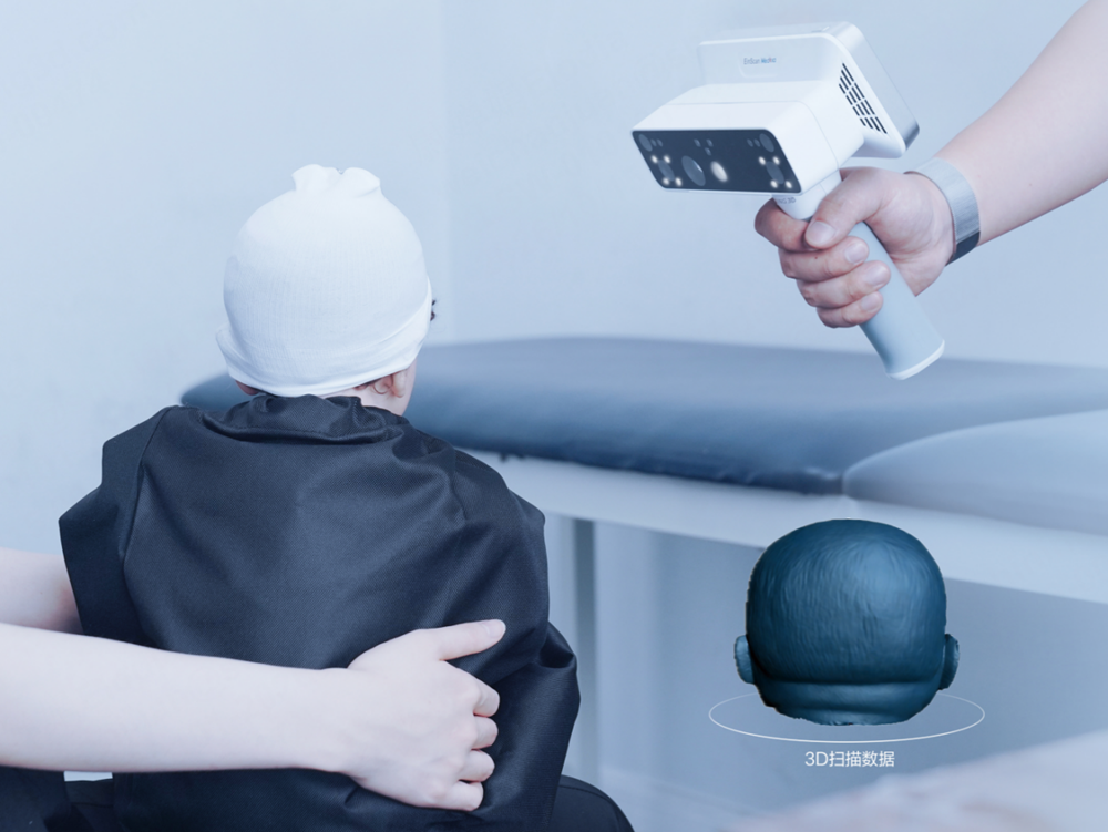 EinScan Medixa双光源无线一体式人体3D扫描仪案例之婴幼儿矫形头盔定制