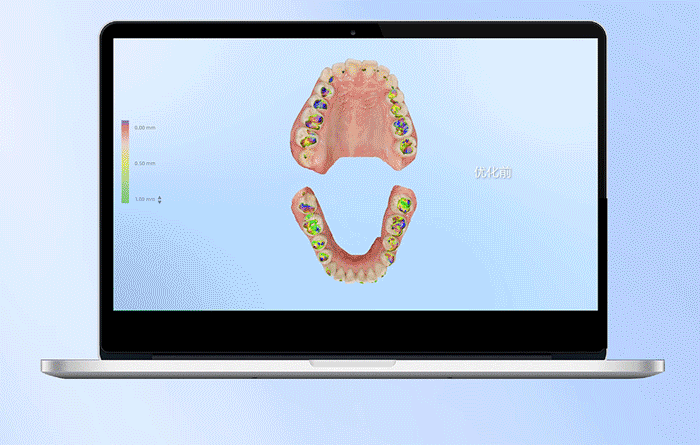 Aoralscan Elf口腔数字印模仪