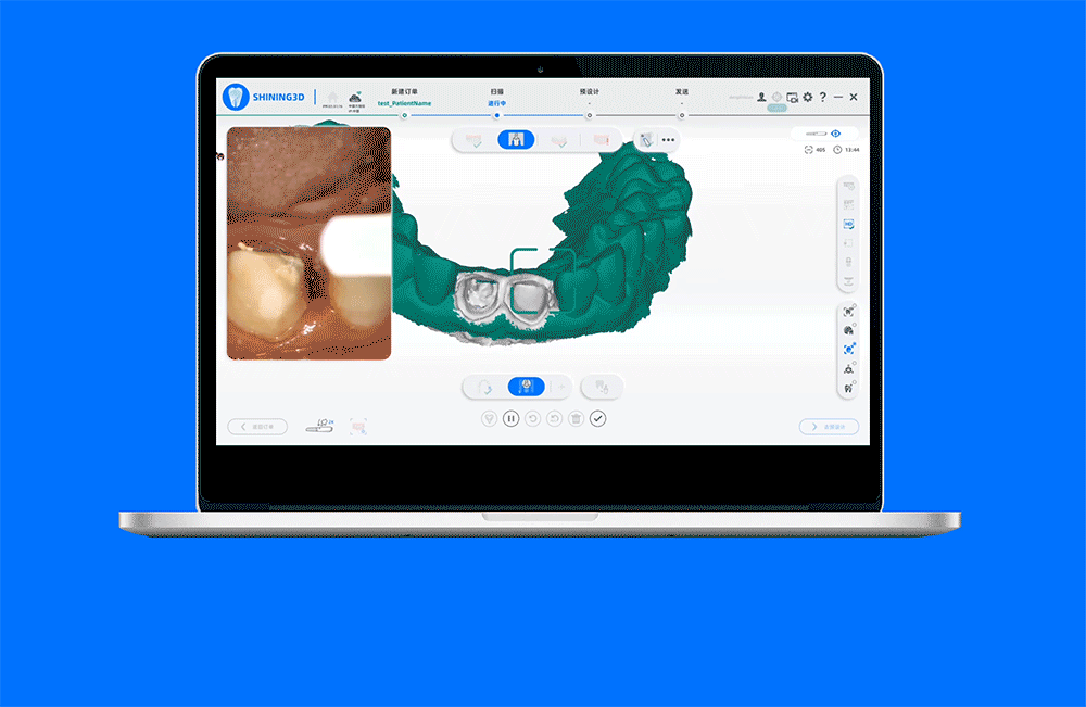 Aoralscan Elf口腔数字印模仪