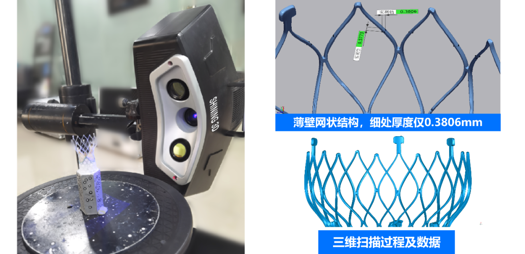 先临天远OptimScan 9M计量级高精度蓝光三维扫描仪扫描人工心脏瓣膜