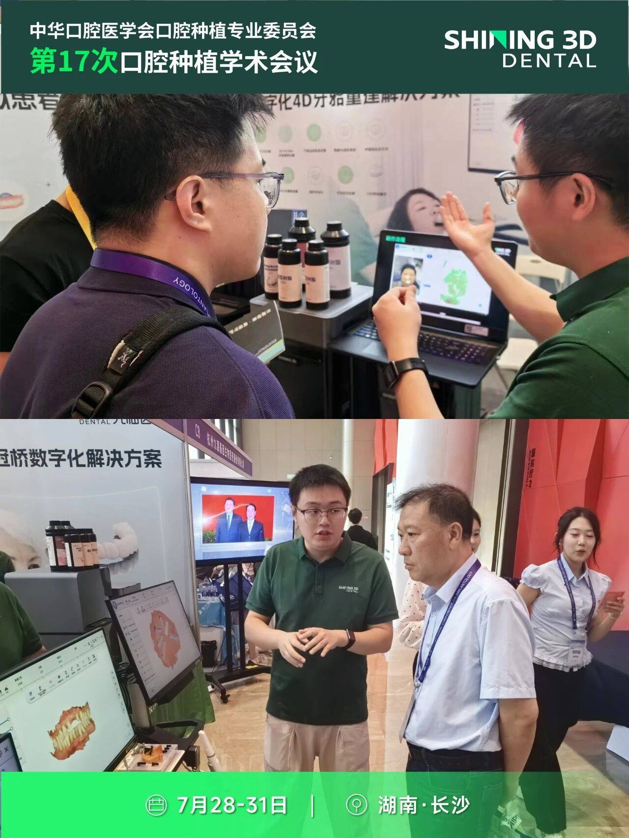 先临齿科精彩亮相第17次口腔种植学术会