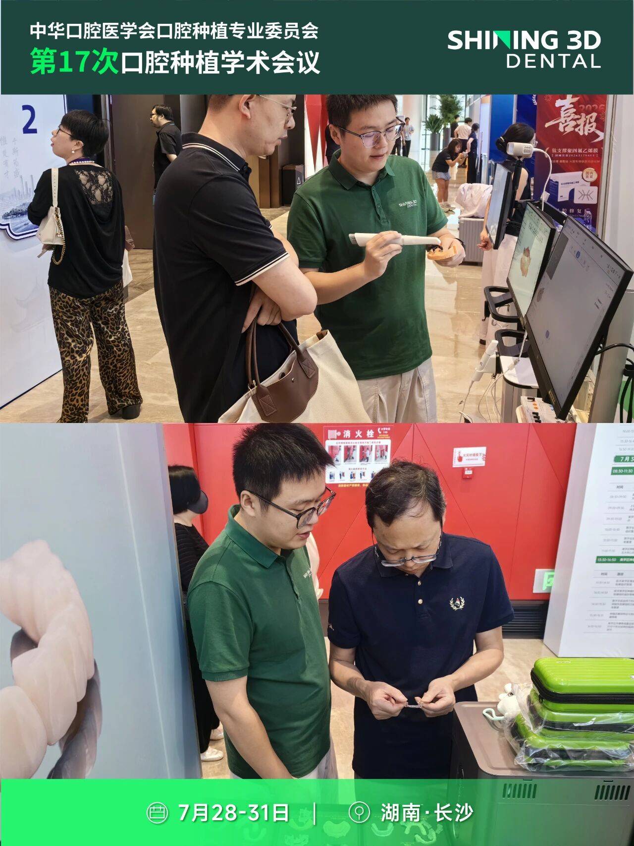 先临齿科精彩亮相第17次口腔种植学术会