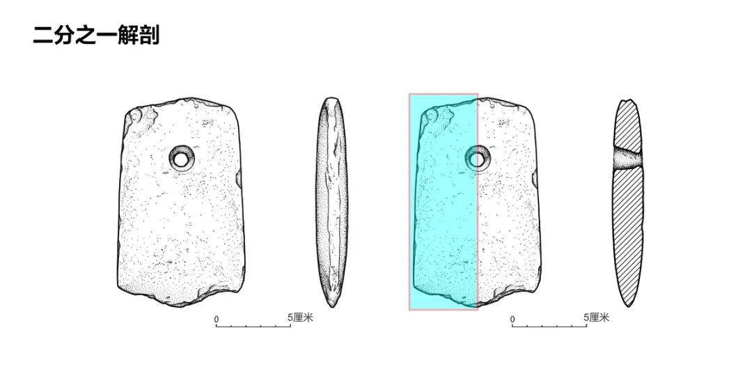 多种专业解剖算法