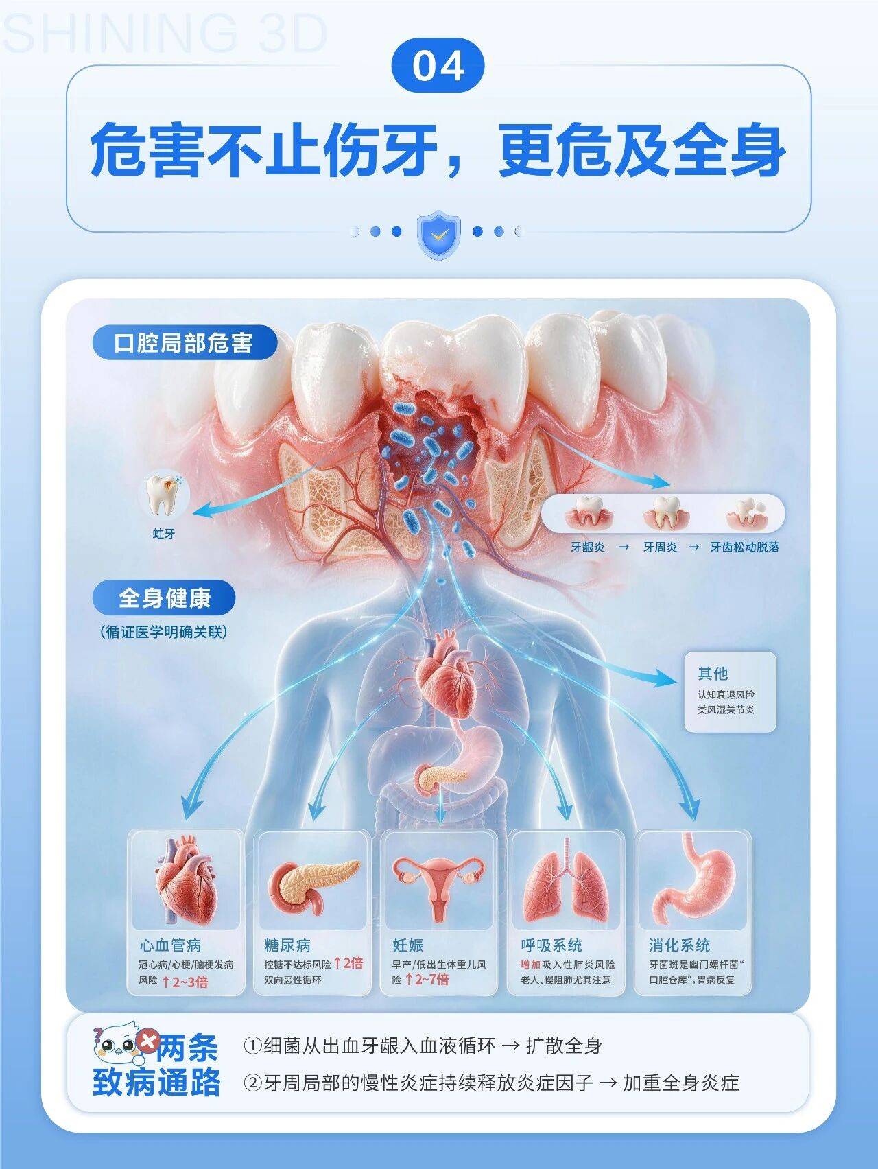 菌斑不止伤牙更危及全身