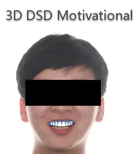 用3D DSD助患者绽放魅力笑容