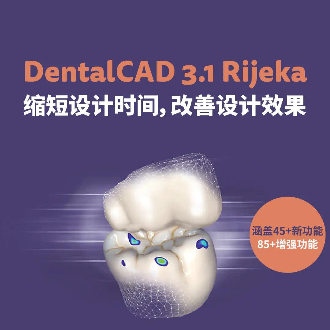 exocad：DentalCAD 3.1 Rijeka 缩短设计时间，改善设计效果