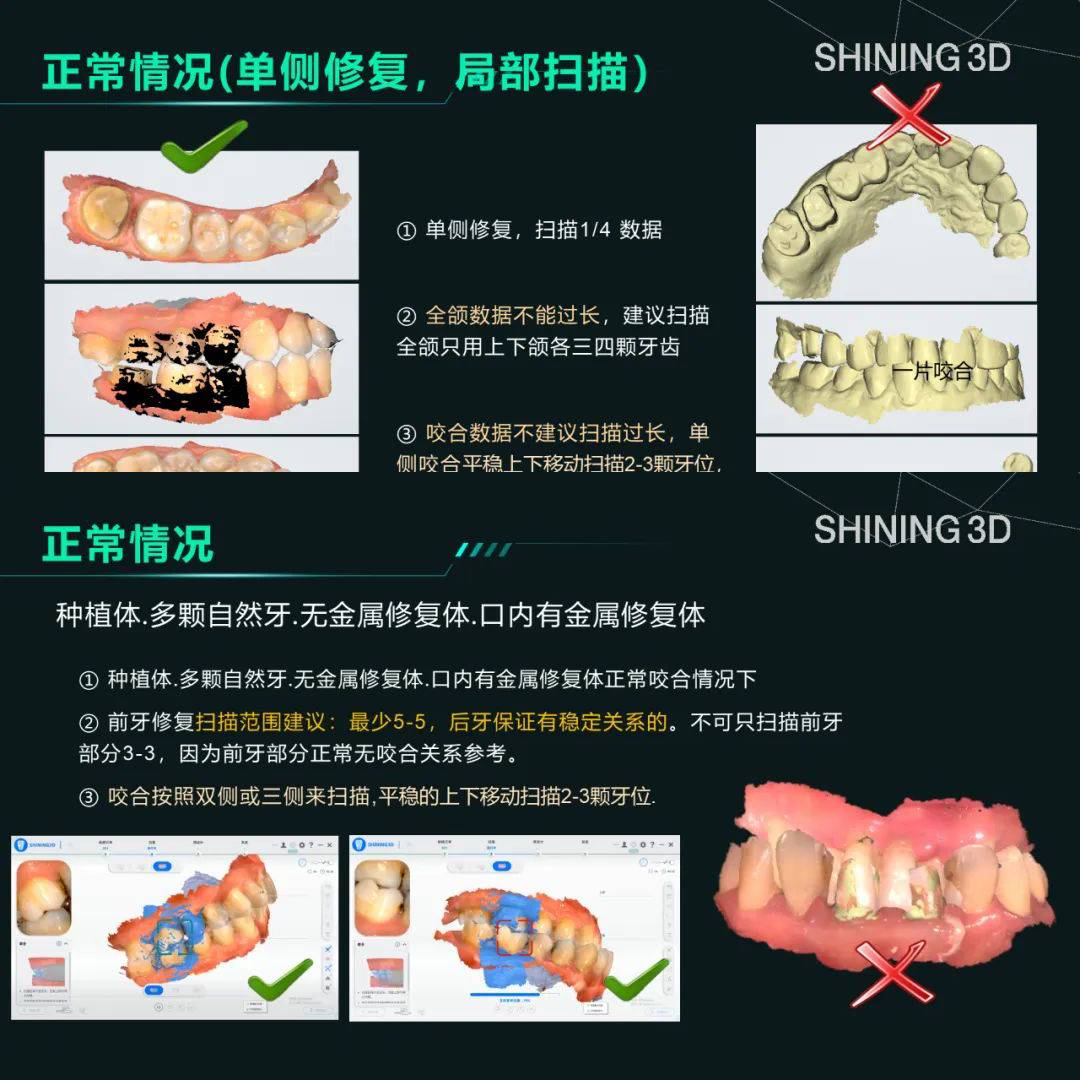 齿科修复_齿科3D数字化_齿科三维扫描仪博客- 先临三维