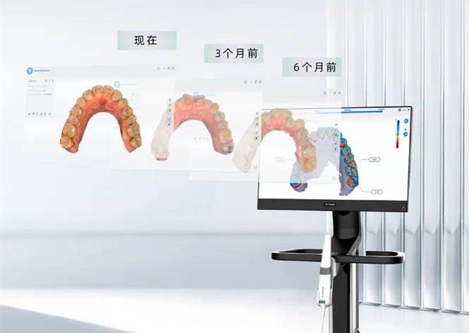 点击了解 | Aoralscan 3i口腔数字印模仪