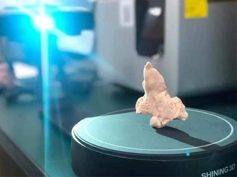 高精度3D扫描和打印技术在遗骨修复领域的应用-先临三维扫描仪